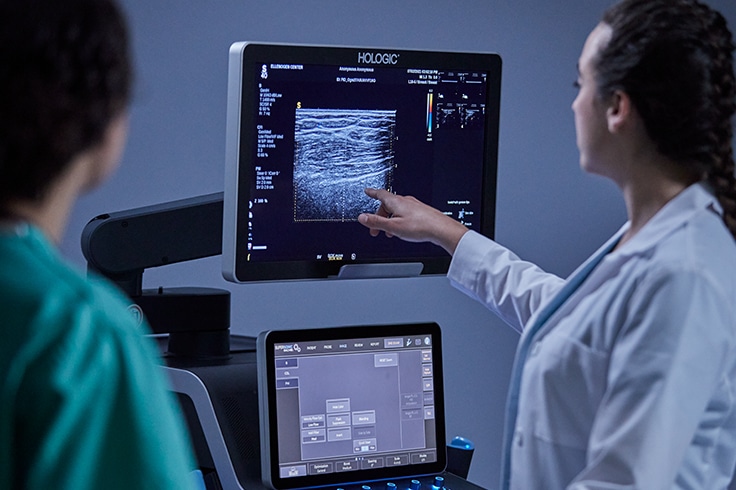 Medical professionals analyzing an ultrasound image on a Hologic machine screen.